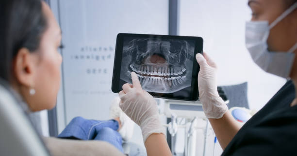 Licensed Tooth Extraction service in South Beach, FL - Smile Center Dentistry